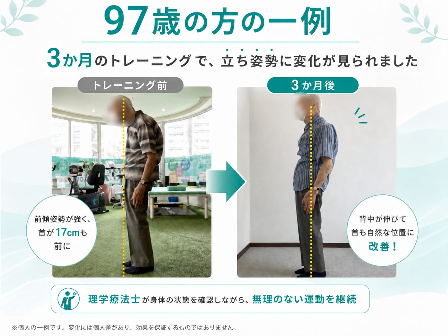 97歳の方の一例。3か月のトレーニング前は前傾姿勢が強く首が前に出ていたが、3か月後は背すじが伸び首も自然な位置に改善した立ち姿勢のビフォーアフター写真